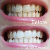 [HCM]Kem đánh răng trắng sáng NUSKIN AP24
