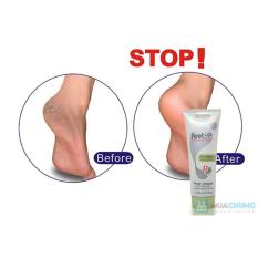 Kem dưỡng da chân và trị nứt nẻ gót chân 75ml - Feedup Comfort
