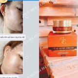 Kem Tri Mụn Sica White ( FACE ACNE CREAM  )