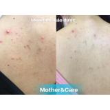 MUỐI TẮM THẢO DƯỢC MOTHER & CARE 22 GR