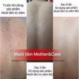 MUỐI TẮM THẢO DƯỢC MOTHER & CARE 22 GR