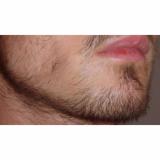 Dung dịch mọc râu Kirkland Minoxidil 5% dạng lỏng (60ml)