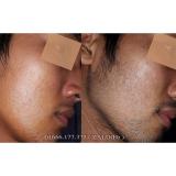Minoxidil 5% Kirkland for Men