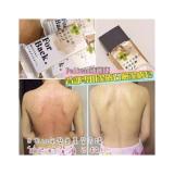 XÀ PHÒNG TRỊ MỤN LƯNG