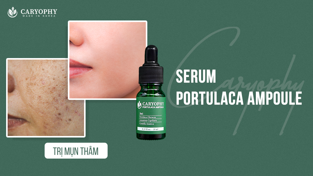 Tinh Chất Dưỡng Da Caryophy Portulaca Ampoule 10ml