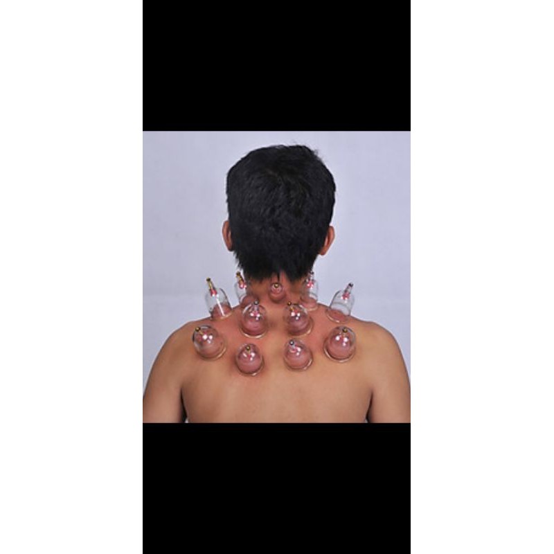 Bộ Giác Hơi Không Lửa Duy Thành 15 Ống