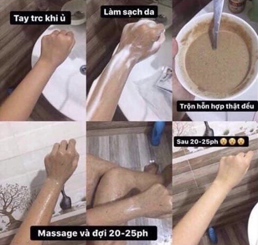 Ủ TRẮNG CÀ PHÊ CHÍNH HÃNG BAO CHECK MÃ VẠCH