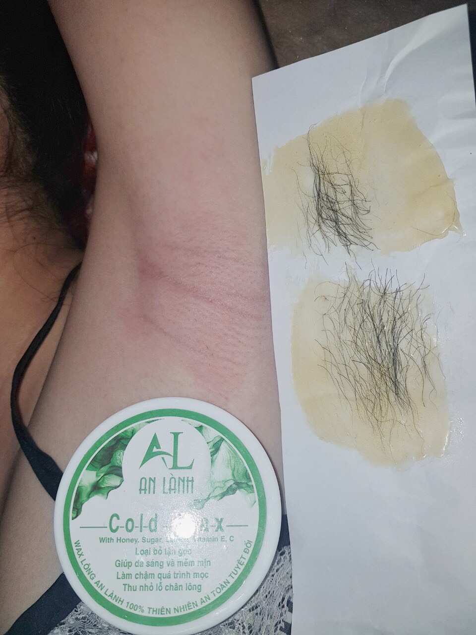 Gói Combo Tẩy Lông An Lành Gồm Wax Lông Và Mỡ Trăn