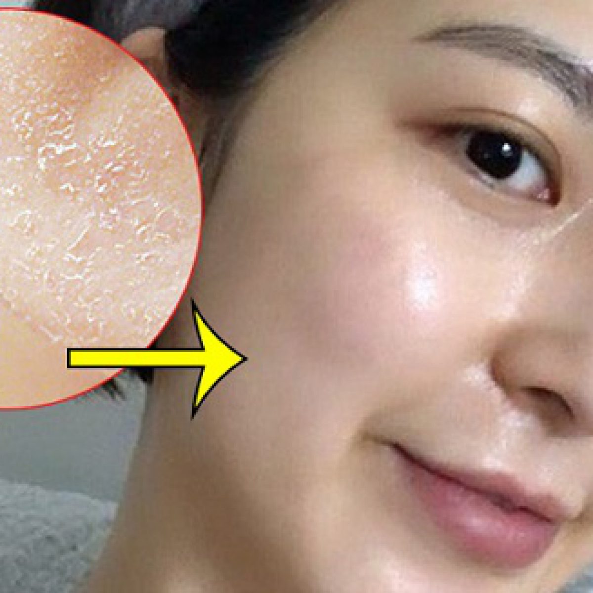 Kem BEZY Bong Da Mặt Xóa Thâm Nám Sạm Trắng Da ( Bong nhanh sau 5 ngày)