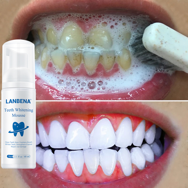 LANBENA Fresh Shining Bọt Kem đánh răng chuyên làm trắng,vệ sinh răng miệng ,loại bỏ mảng bám vết bẩn