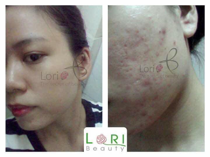 KEM LORI B