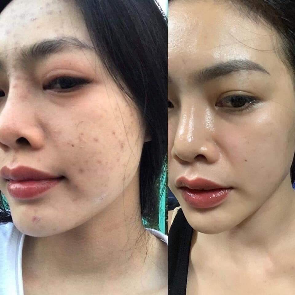 Tái Tạo Thượng Đỉnh + Linh Chi Bột