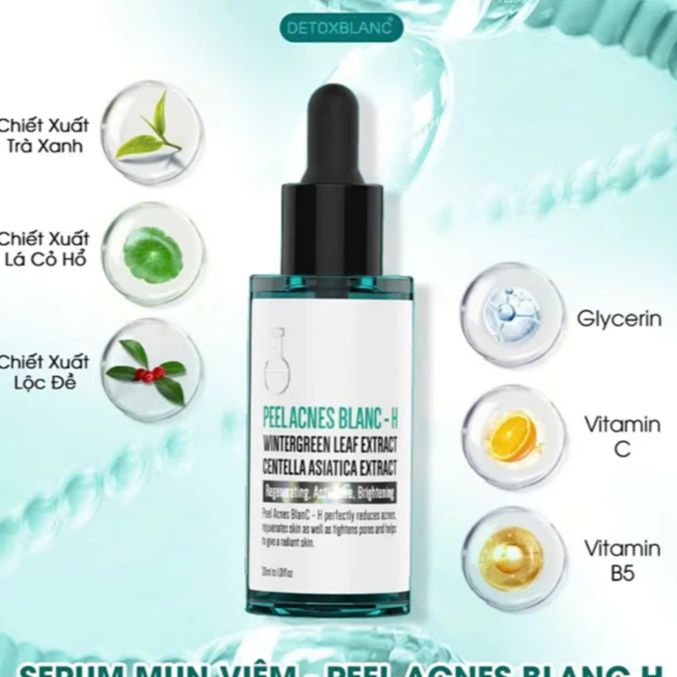 Serum mụn lộc đề M (PEEL ACNES BLANC– M 20ml)