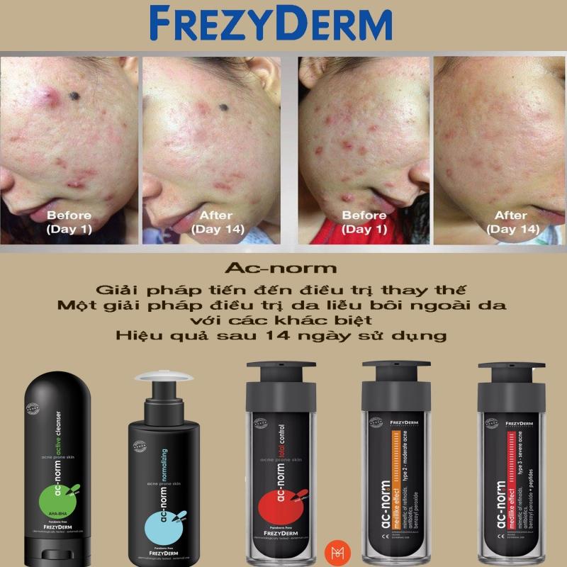 LOTION CHĂM SÓC DA DẦU MỤN -   FREZYDERM AC-NORM NORMALIZING LOTION 200ML