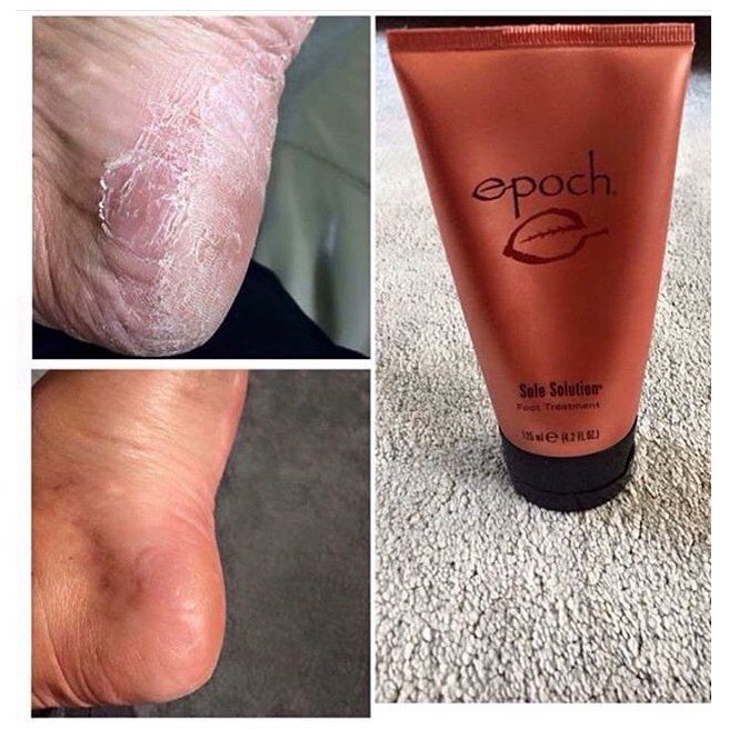 [HCM]Kem Epoch khô nứt gót chân Nuskin Epoch 125ml