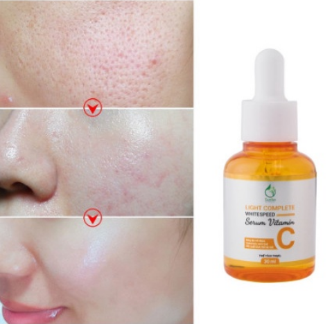 Serum sáng da mờ thâm Vitamin C 30ML SUZIKO