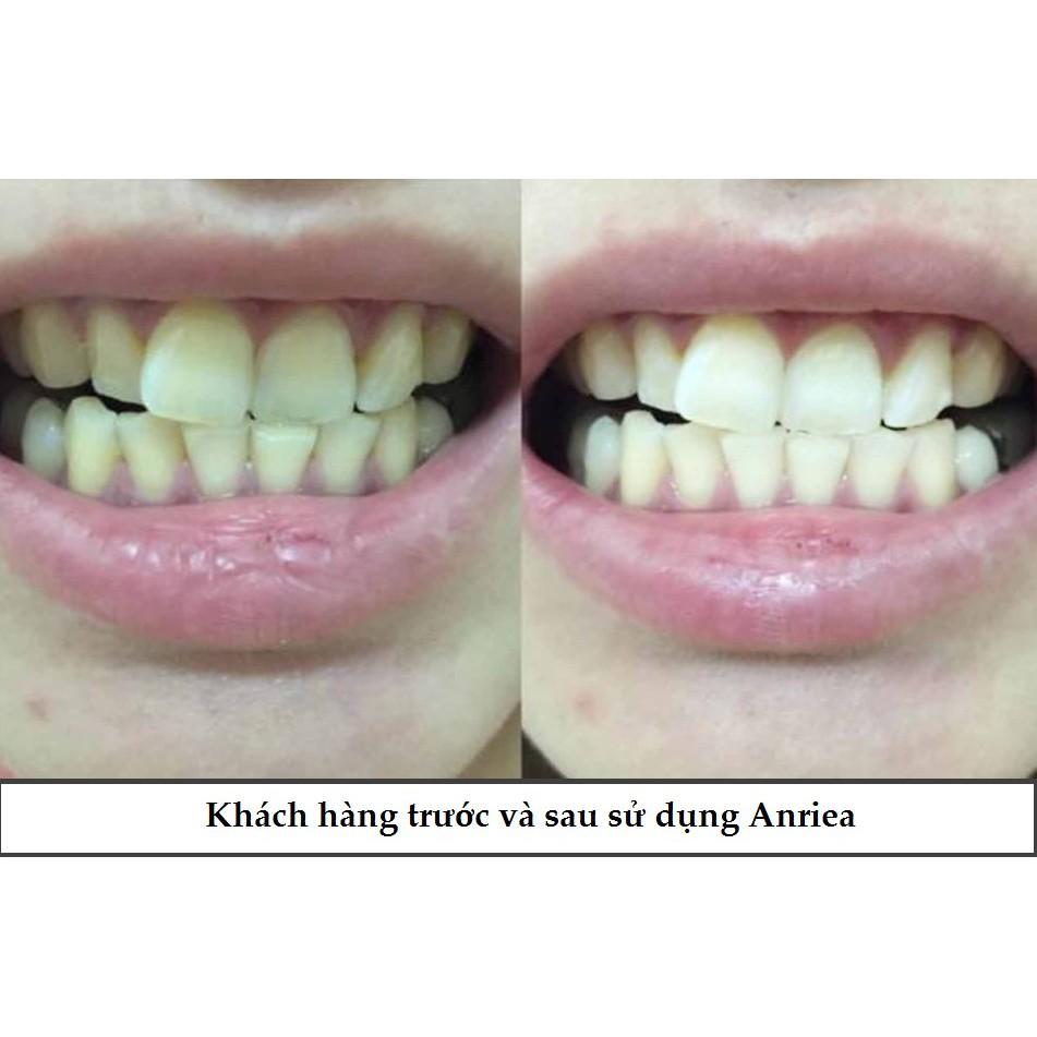 COMBO [LIỆU TRÌNH 14 NGÀY DÁN TRẲNG RĂNG ANRIEA 3D + KEM ĐÁNH RĂNG CHANH] TẶNG miếng dán lẻ + 1 bàn chải + 1 smile maker