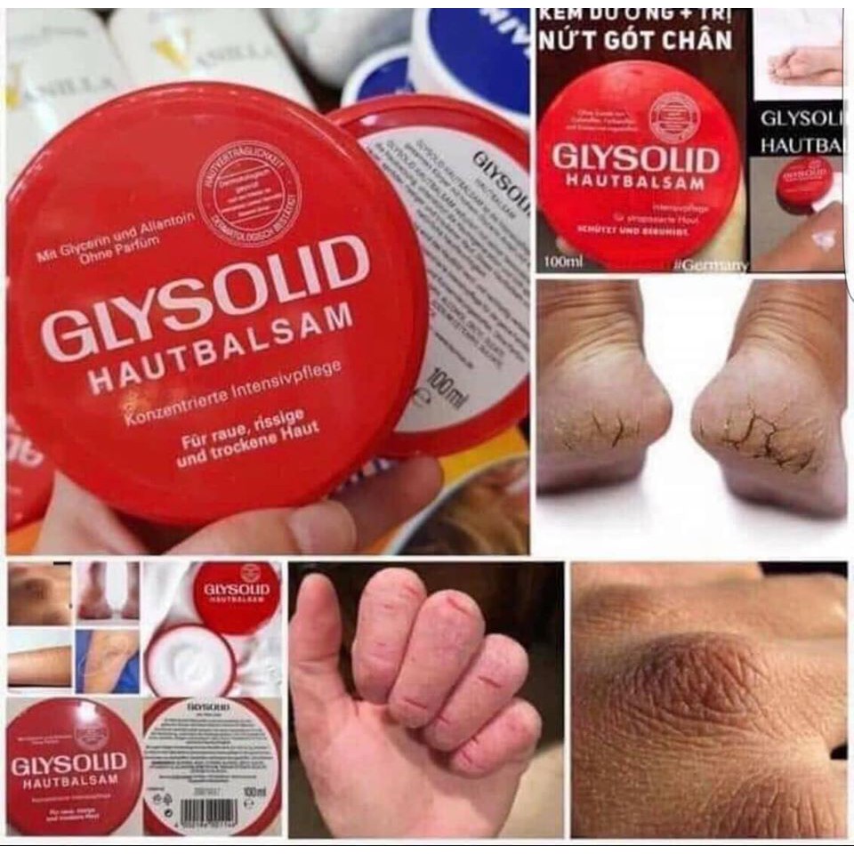 Kem chống nẻ Glysolid ngừa nứt nẻ da, nứt gót chân, 100 ml - Đức