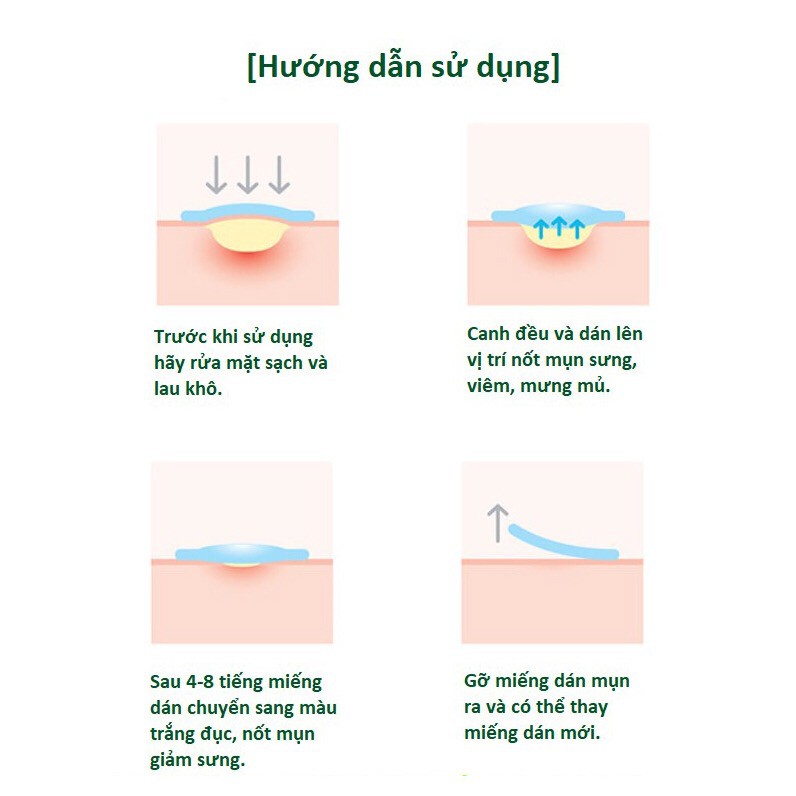 SOME BY MI - Miếng dán mụn giảm sưng mụn Clear Spot Patch gói 18 miếng