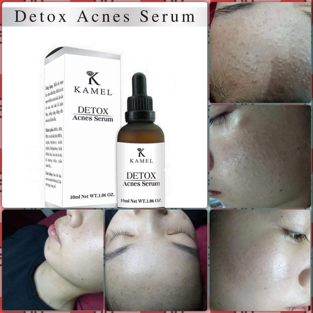 SERUM DEXTOX ACNES KAMEL