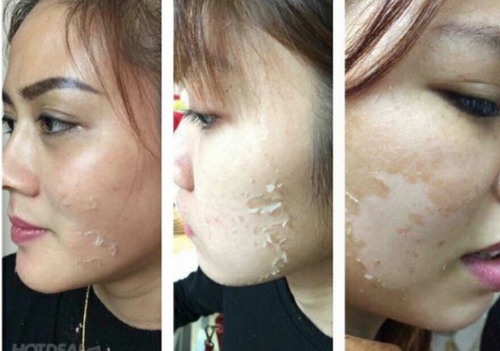 [HCM]Feel Thay da Niraci của Hàn Quốc  tái tạo da mới căng mịn