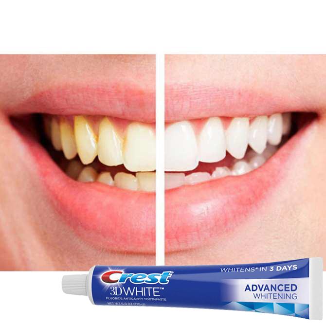 [HCM]KEM ĐÁNH RĂNG CREST 3D WHITE ADVANCED WHITENING 158G