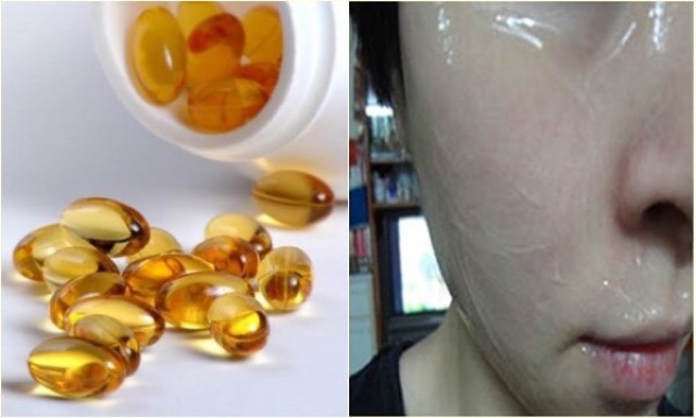 Vitamin E Dưỡng Da 10ml