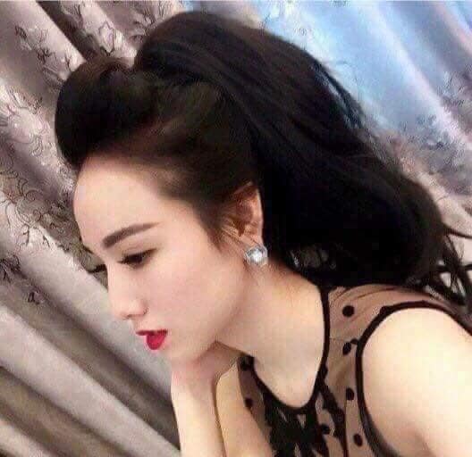Kẹp phồng mái 3 chi tiết