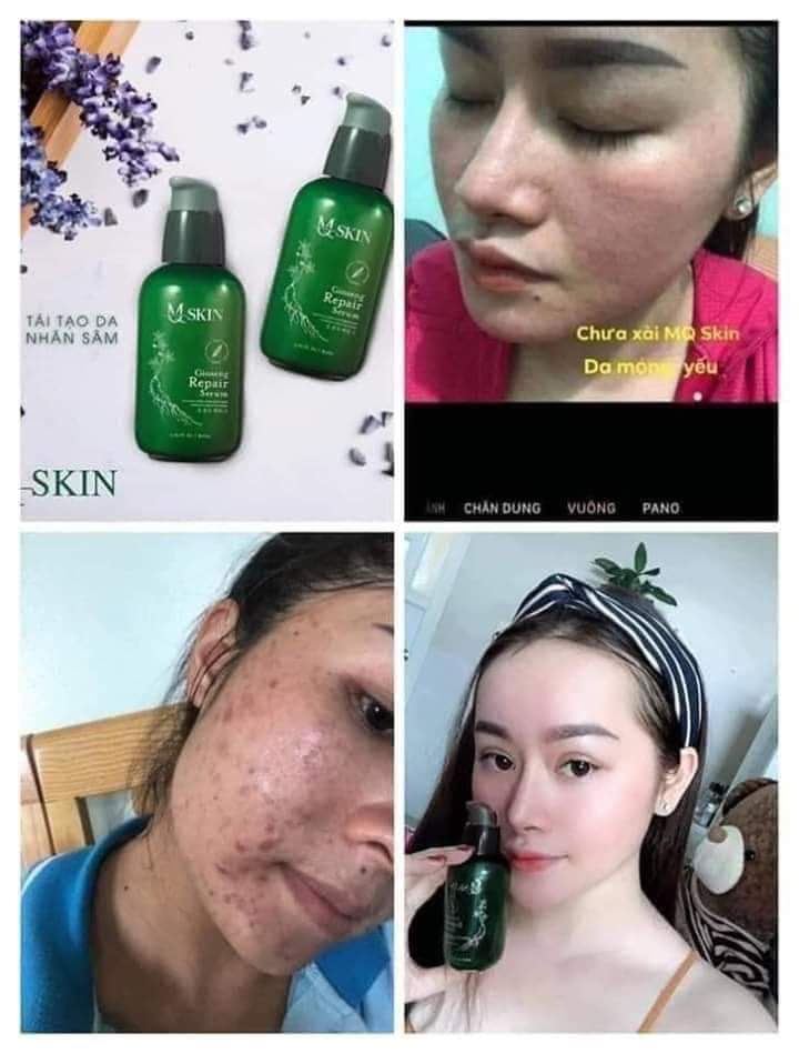 [HCM]Thay da Nhân Sâm MQSKIN