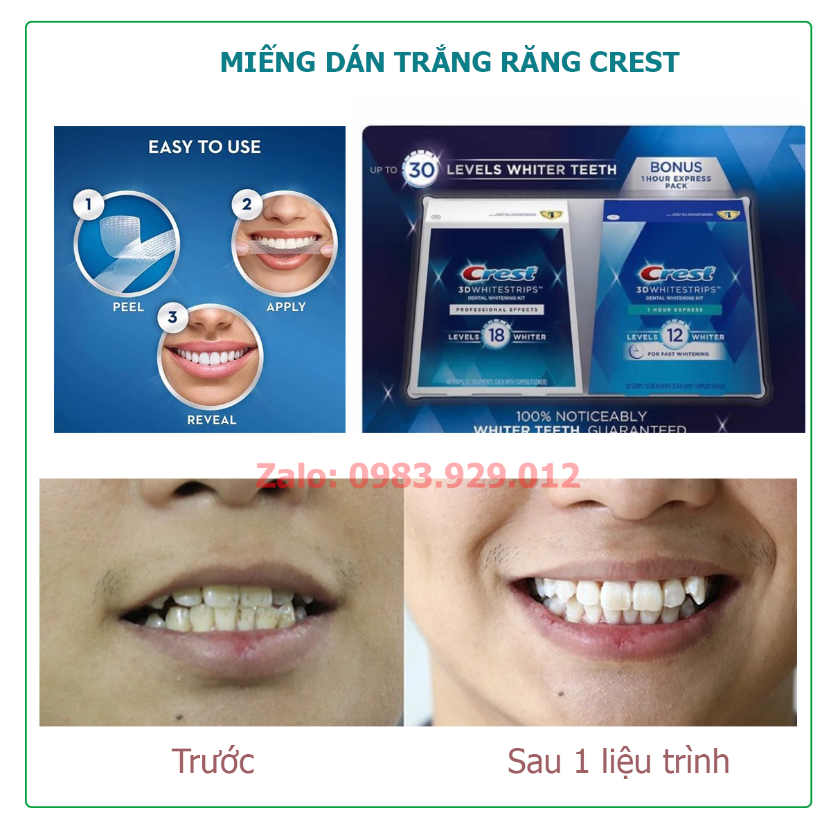 Miếng dán trắng răng Crest 3D White Professional Effects, 1 hour Express, Supreme Bright, Sensitive Bright, Vivid