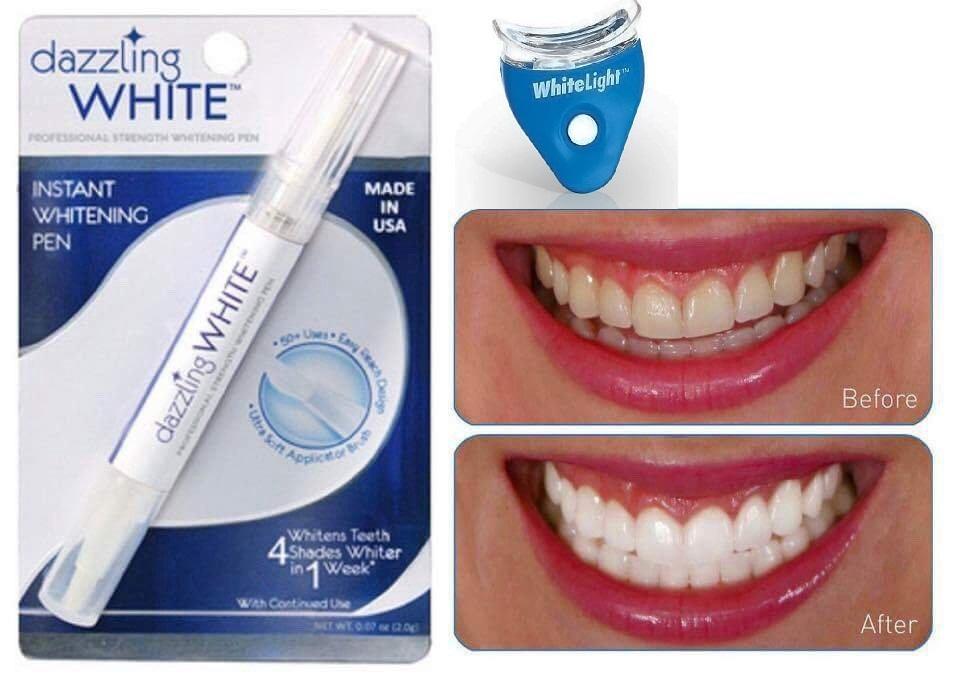 Combo 2 Bút tẩy trắng răng Dazzling White