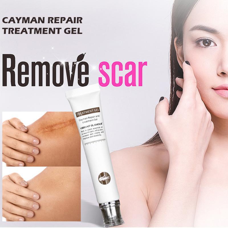 VG Scar Remover Acne Cream Scars Repair Stretch Marks Pregnancy Scars Scalded Surgery Scar Anti-Aging Moisturizing nhập khẩu