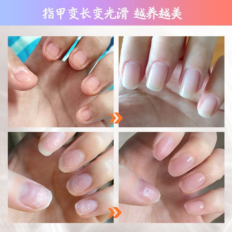 Dầu Dưỡng Viền Móng VINIMAY 20ml