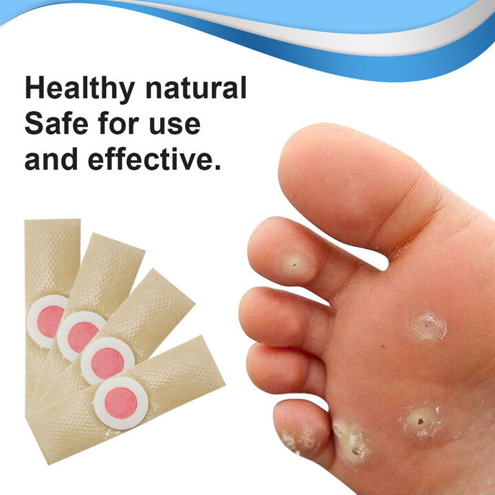 Miếng dán tẩy mụn cóc, mụn nhọt vết chai C24 (Hộp 24 miếng)