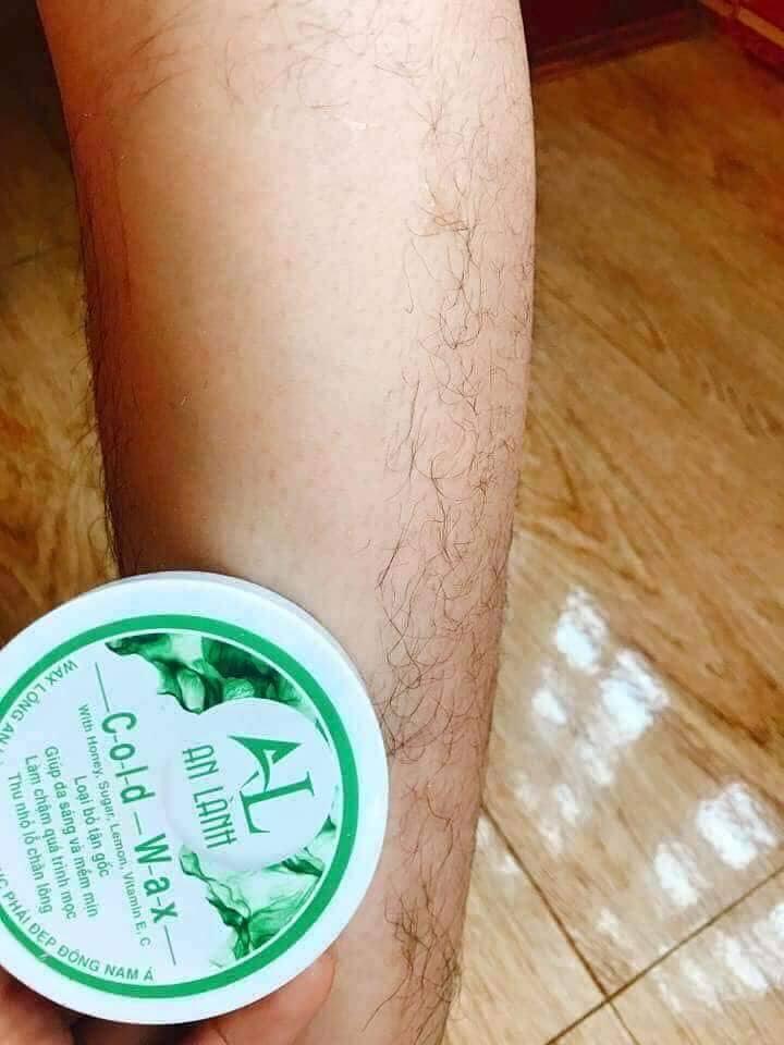 Combo triệt lông An Lành