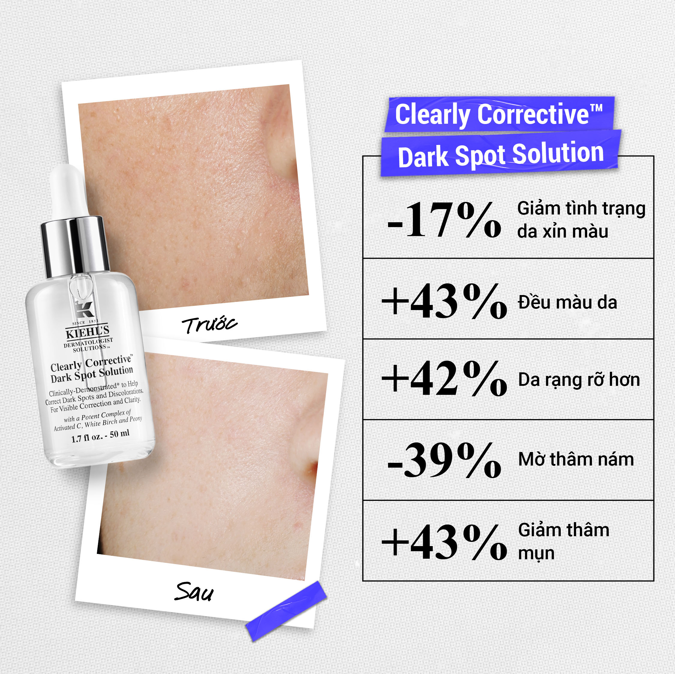 [VOUCHER 12%_TẶNG QUÀ ĐƠN 1.8 TRIỆU] [DEAL] Serum Vitamin C Kiehl's Clearly Corrective™ Dark Spot Solution 30ML