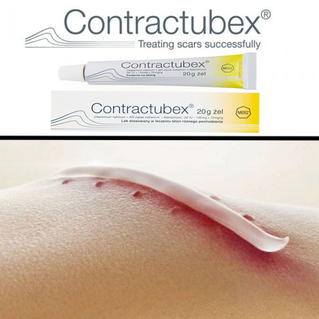 Kem Sẹo Contractubex Nội Đia Ba Lan 20g