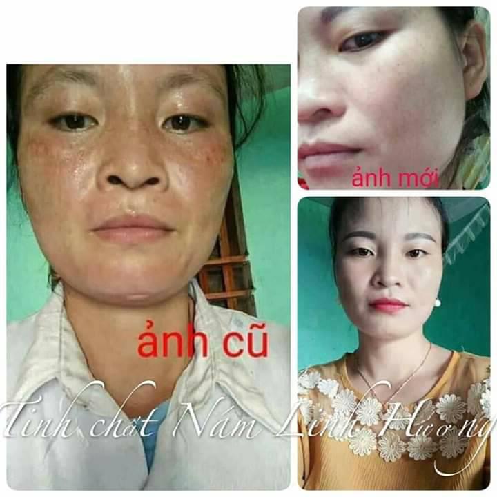 Tinh chất nám Linh Hương