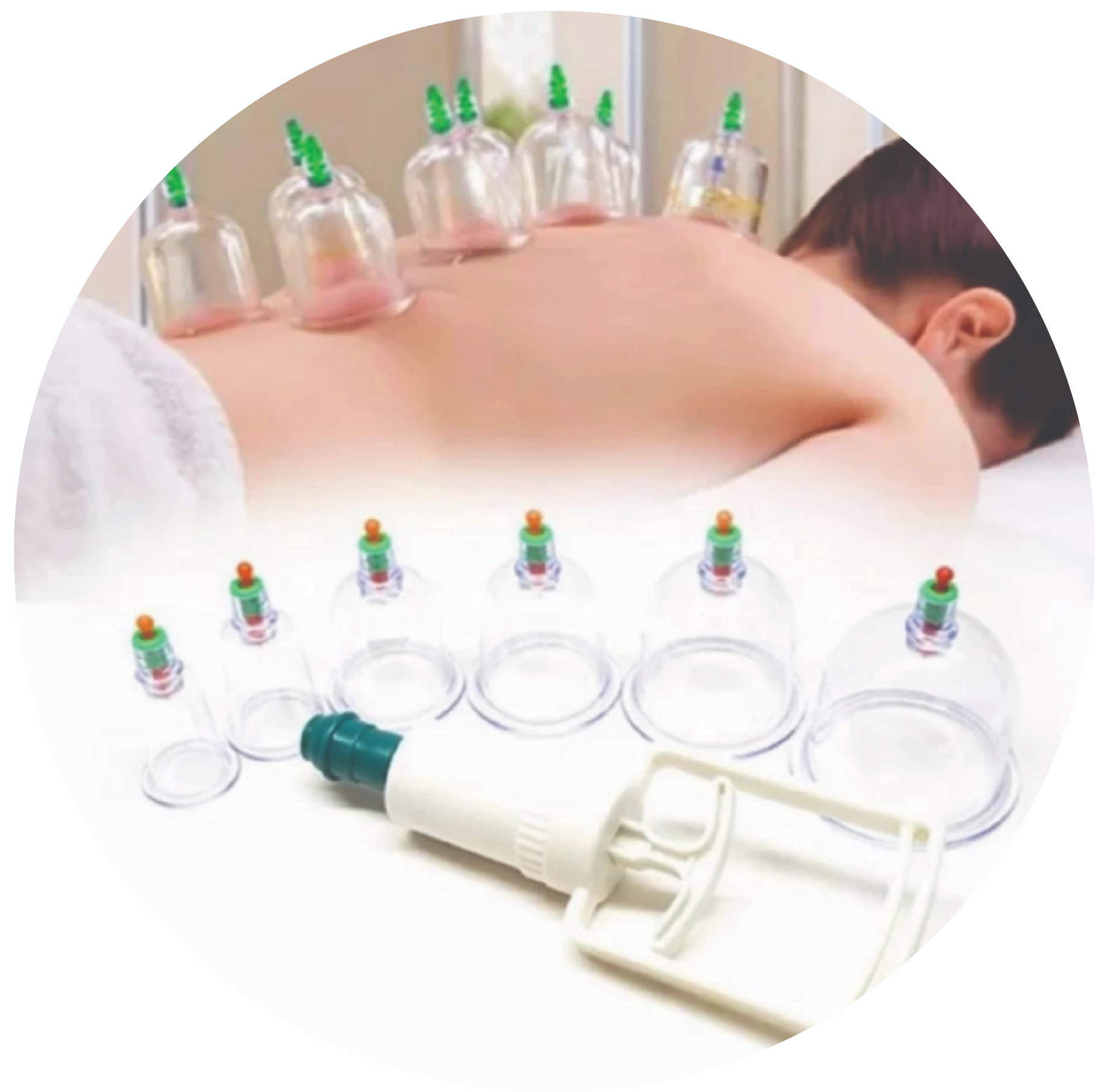 Bộ Giác Hơi Không Dùng Lửa 12 Món