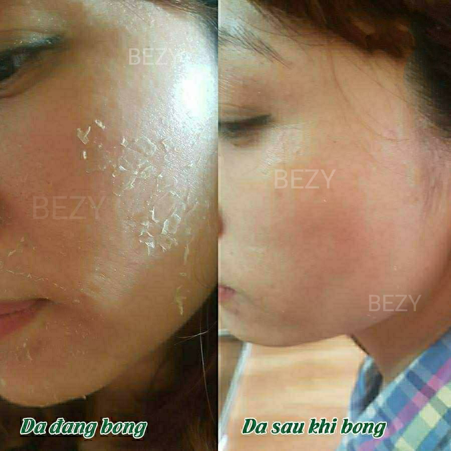 [HCM]Kem Bong Trắng Da BEZY Mờ Nám Thâm Sạm Tàn Nhang