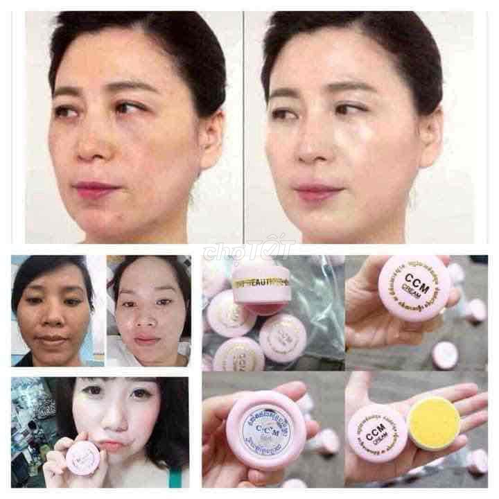 Kem giảm nám tàn nhang CCM CREAM nội địa