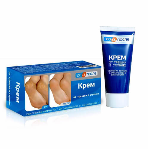 Kem nứt gót chân Kpem Nga