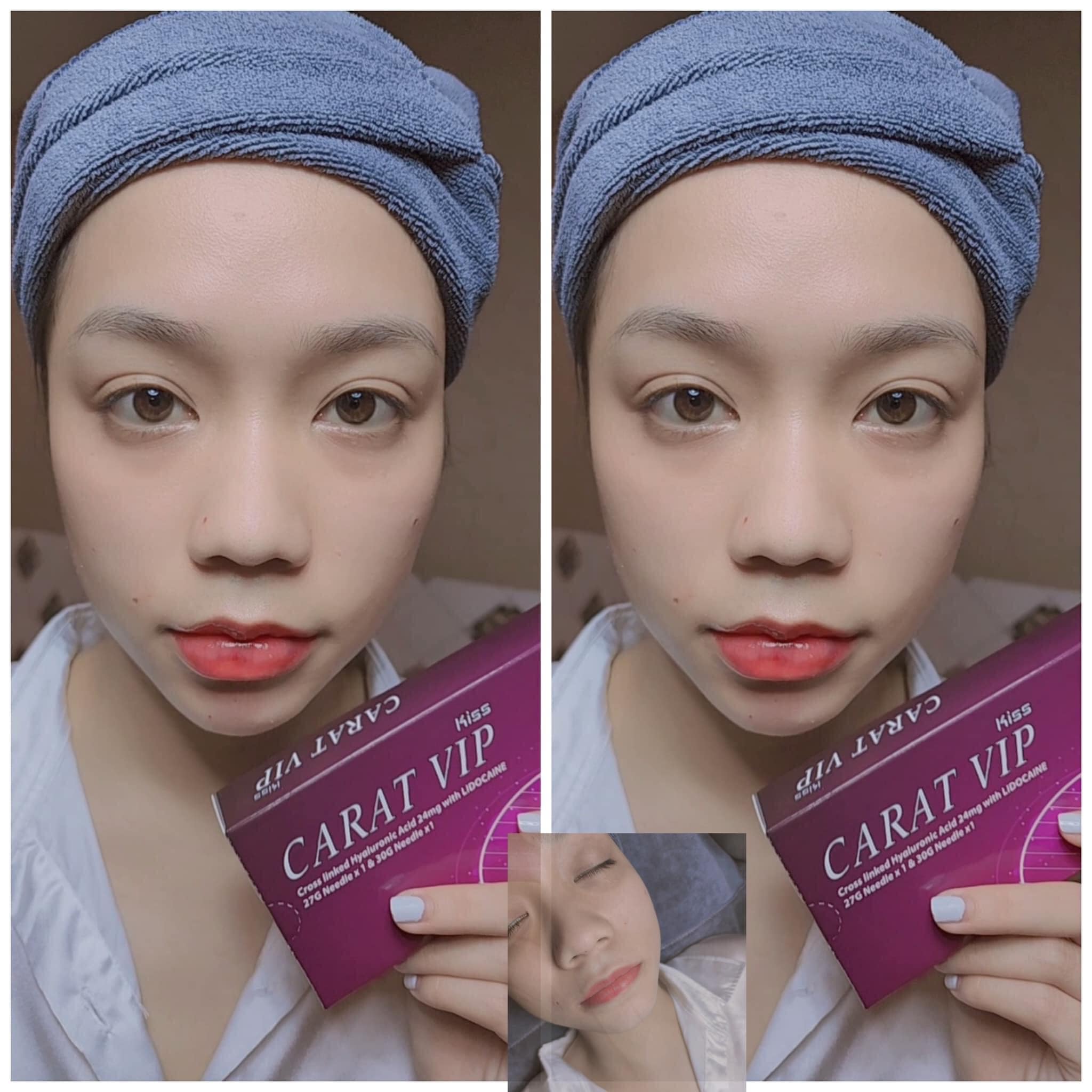 FILLER CARAT VIP