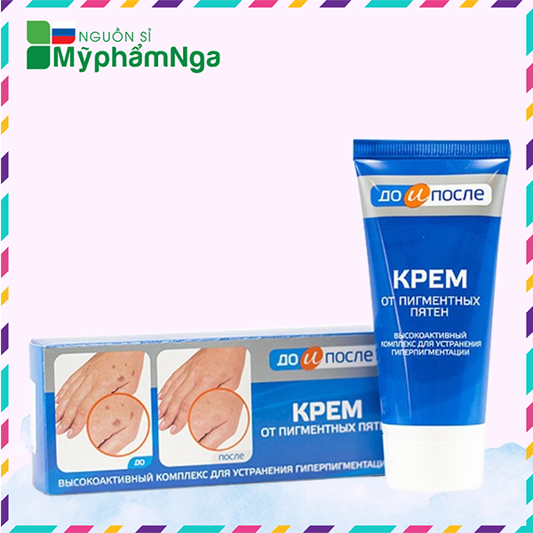 Kem t-r-ị đồi mồi Nga - Kem đồi mồi