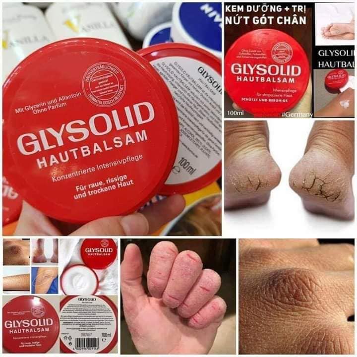 Kem bôi nẻ gót chân Glysolid Hautbalsam, 100ml