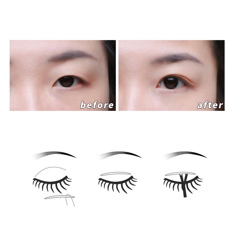 Miếng Dán Mí Vân Lưới Hộp 600 Cái