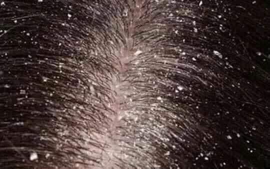 Dầu gội thảo mộc TKH