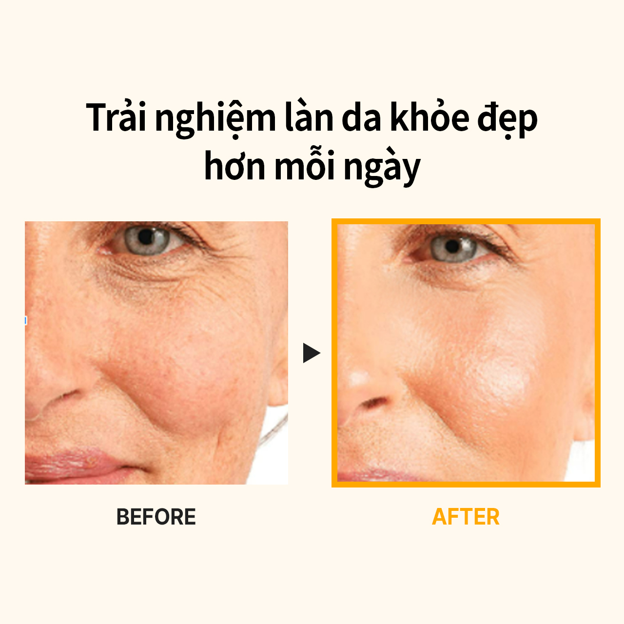 [MEDIPEEL Official]GOLD AGE TOX H8 CREAM
