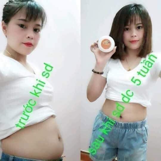 kem ủ tiêu mỡ gia Hân
