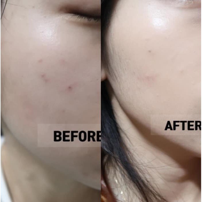 [ CELLMULA ] Kem Chấm Mụn Cellmula Ac Clear Spot